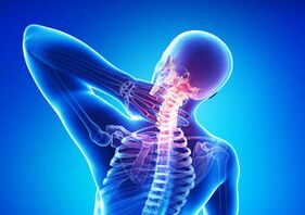 Semne de osteochondroză cervicală