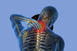 Simptomele osteochondrozei cervicale