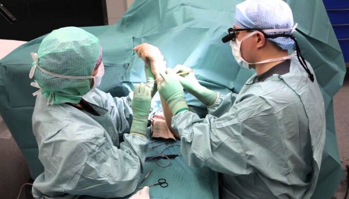 tratamentul chirurgical al durerii la nivelul articulațiilor degetelor