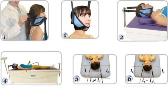 tratamentul osteocondrozei cervicale prin tracțiune