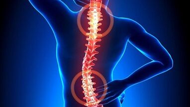 mecanismul de dezvoltare a osteocondrozei