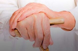 durere la nivelul articulațiilor degetelor cu poliartrită reumatoidă