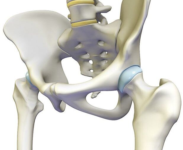 Osteocondroza provoacă o durere ascuțită în articulația șoldului