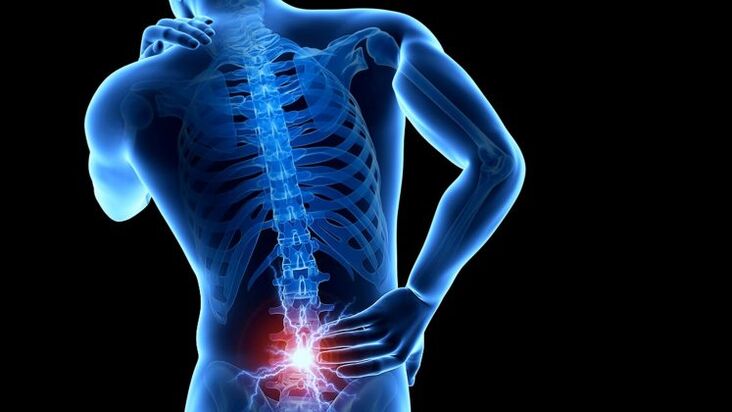 dureri de spate cu osteocondroză lombară